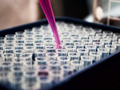 Hazte gratis la prueba de COVID 19 en estos Centros de salud en CDMX