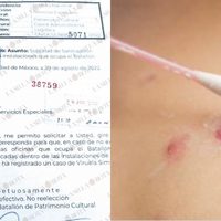 Este caso de viruela sísmica causó que sanitizaran base en CDMX