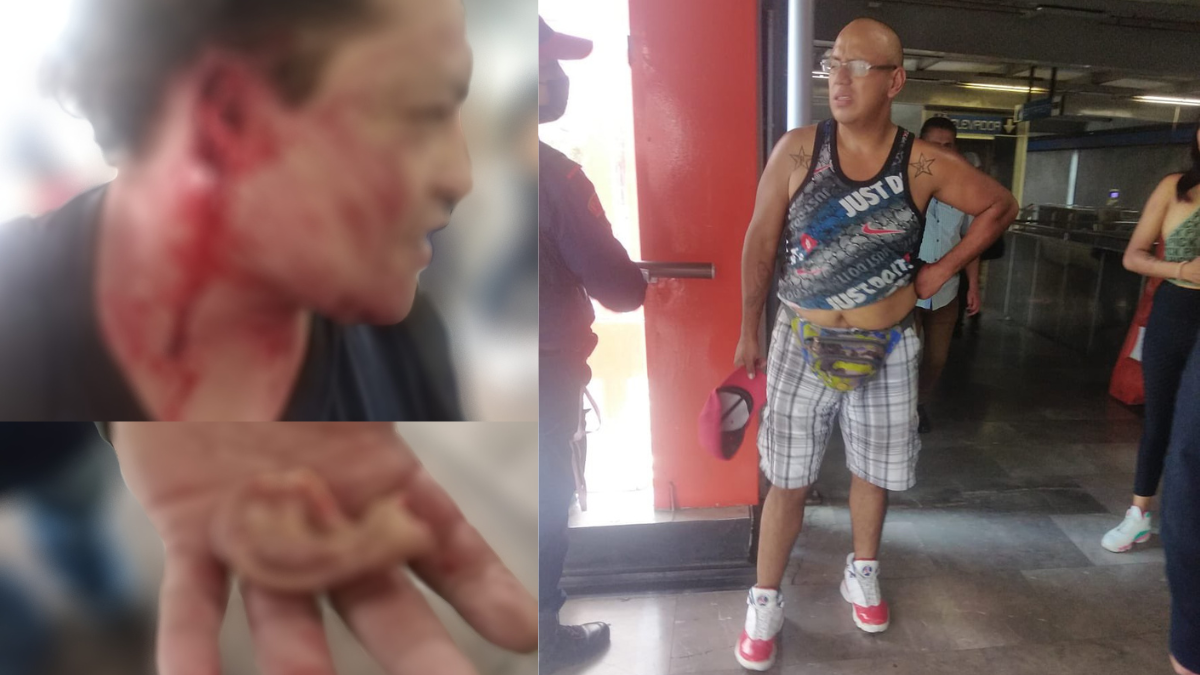 Pasajero muerde y arranca oreja a hombre durante pelea en Metro Xola. Foto: Jorge Flores