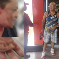 Pasajero muerde y arranca oreja a hombre durante pelea en Metro Xola