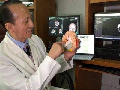 Implanta ISSSTE chip cerebral en pacientes con Parkinson