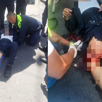 Conductor atropella y le rompe la pierna a mujer policía en el Centro CDMX