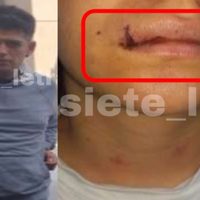 Policía CDMX rescata a mujer de ser asesinada por su pareja en la Cuauhtémoc
