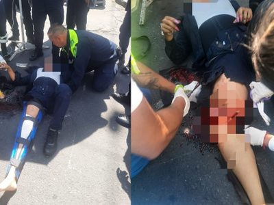 Conductor atropella y le rompe la pierna a mujer policía en el Centro CDMX